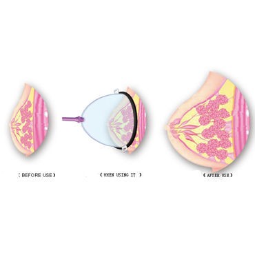 Baile вакуумная помпа