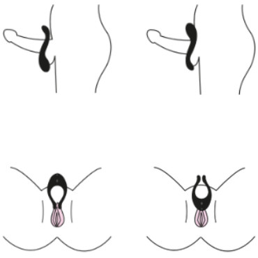 Satisfyer Endless Joy, розовый