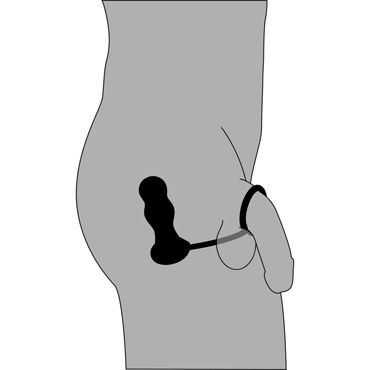 Orion Prostata Trainingsset Rebel