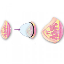 Baile Breast Pump, одинарная